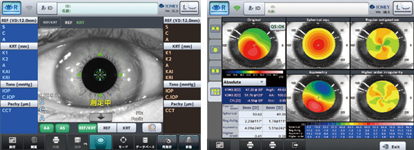 Auto Ref-Topographer RT-7000