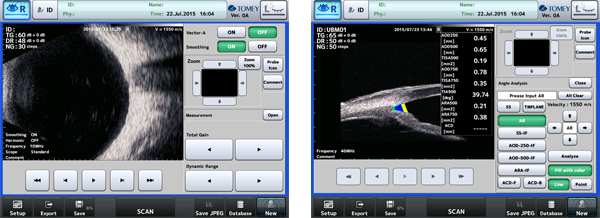 Ultrasonic A/B Scanner and Pachymeter UD-800